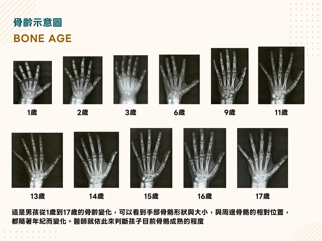 藉由骨骼成熟程度與周邊骨骼相對位置判讀骨齡